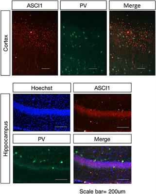 Ketone Bodies Inhibit the Opening of Acid-Sensing Ion Channels (ASICs) in Rat Hippocampal Excitatory Neurons in vitro